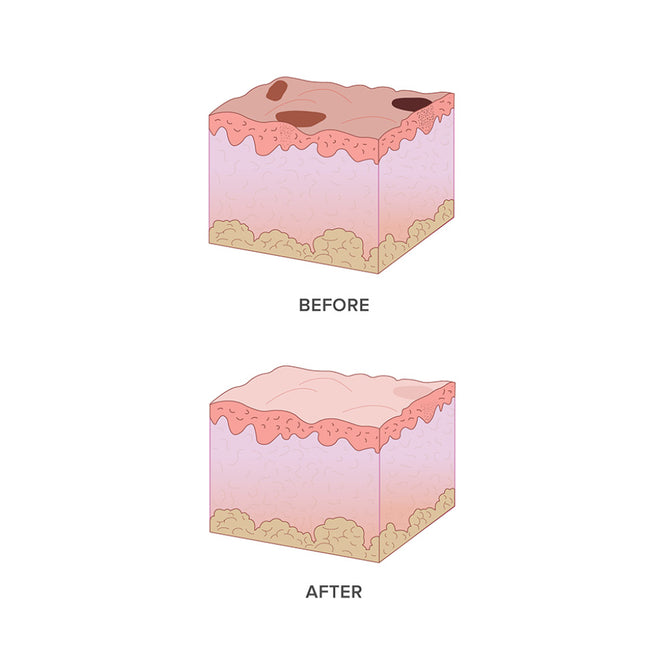 DermaV – Cynosure Lutronic Australia